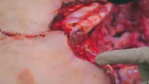 死体に触るの大好き!